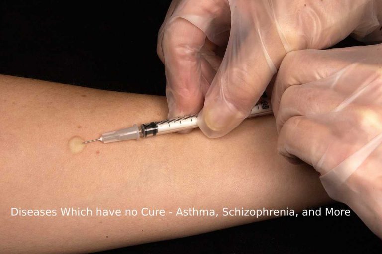 diseases which have no cure