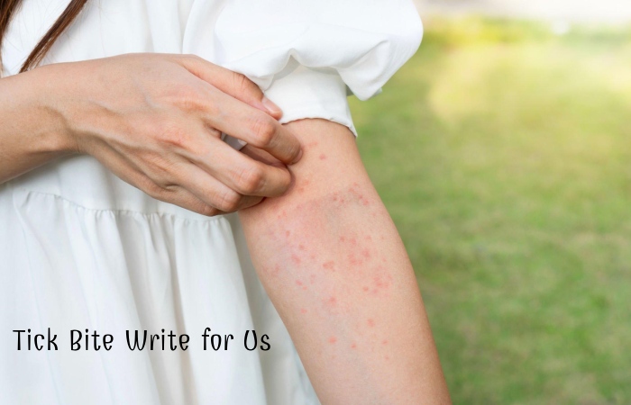 Tick Bite Writes For Us