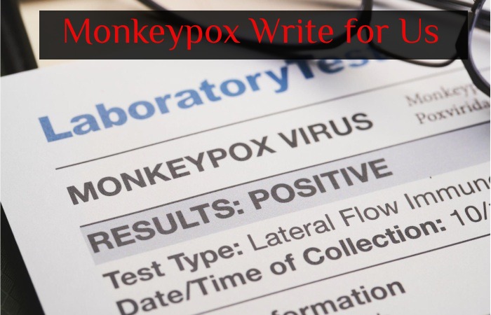 Monkeypox Write for Us