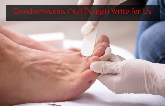 Onychomycosis (Nail Fungal) Write for Us