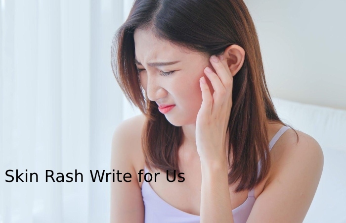 Skin Rash Write for Us