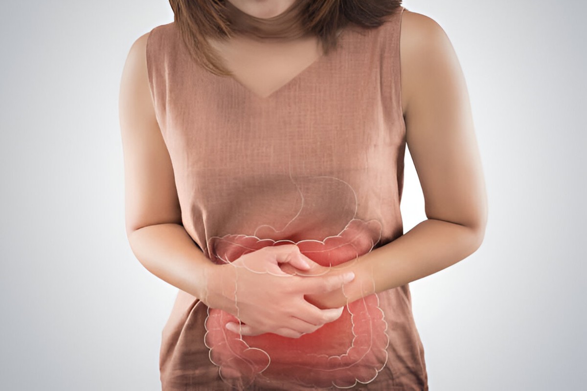 Stomach Acid Write for Us, Guest Post, Contribute, and Submit Post