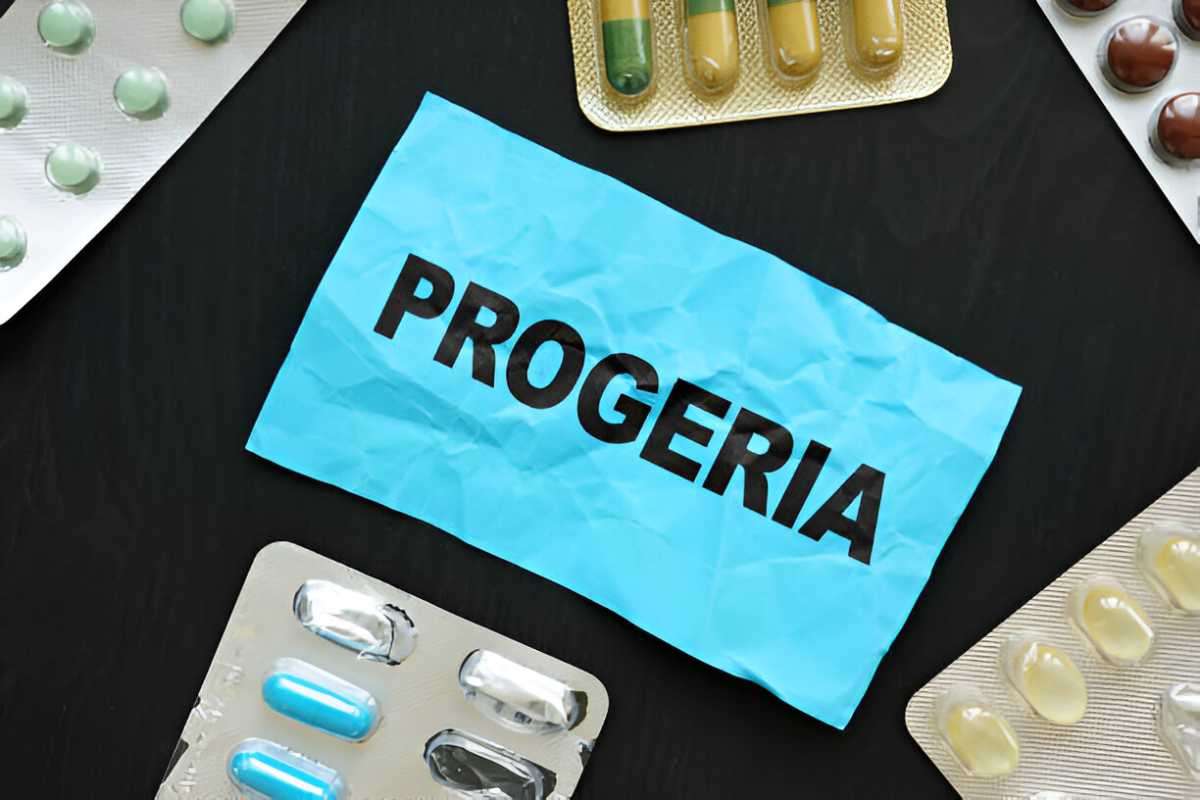 Progeria Write for Us - Guest Post, Contribute, and Submit Post