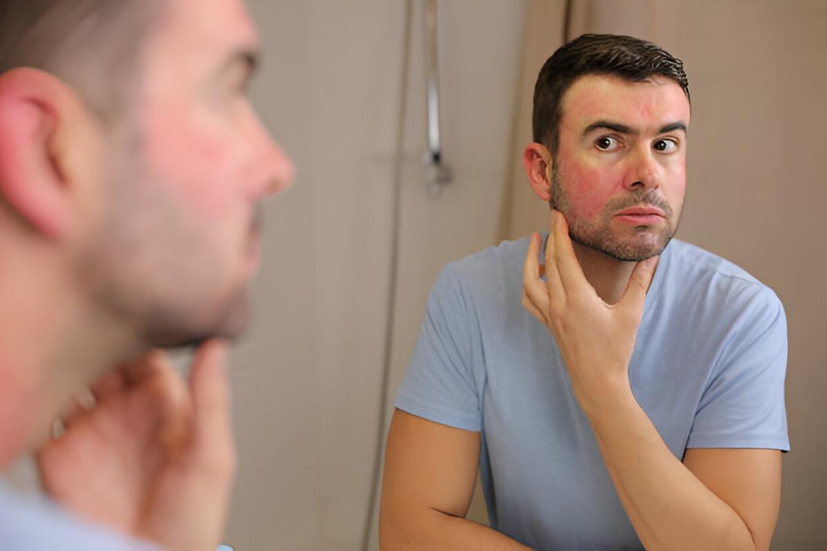 Skin Rash Write for Us - Guest Post, Contribute, and Submit Post